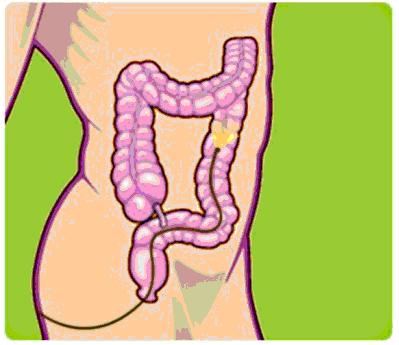 colon