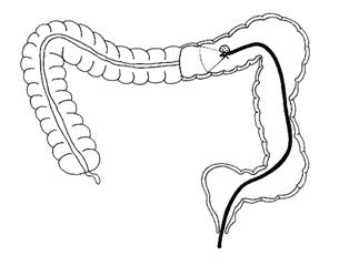 colon2